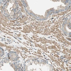Immunohistochemical staining of human prostate shows moderate cytoplasmic positivity in smooth muscle cells.