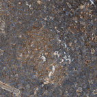 Immunohistochemical staining of human lymph node shows moderate to strong membranous positivity in non-germinal and germinal center cells.