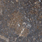 Immunohistochemical staining of human lymph node shows moderate to strong membranous positivity in non-germinal and germinal center cells.