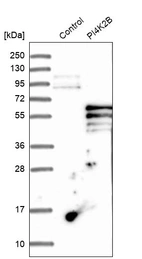 Western blot analysis in control (vector only transfected HEK293T lysate) and PI4K2B over-expression lysate (Co-expressed with a C-terminal myc-DDK tag (~3.1 kDa) in mammalian HEK293T cells, LY402666).