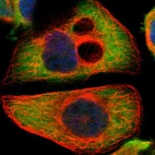 Immunofluorescent staining of human cell line A-431 shows localization to cytosol.