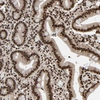 Immunohistochemical staining of human duodenum shows strong nuclear positivity in glandular cells.