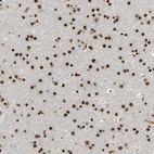 Immunohistochemical staining of human cerebral cortex shows strong nuclear positivity in neuronal cells.