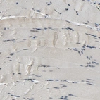 Immunohistochemical staining of human skeletal muscle shows no nuclear positivity in myocytes as expected.