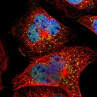Immunofluorescent staining of human cell line A-431 shows localization to nucleoplasm & vesicles.