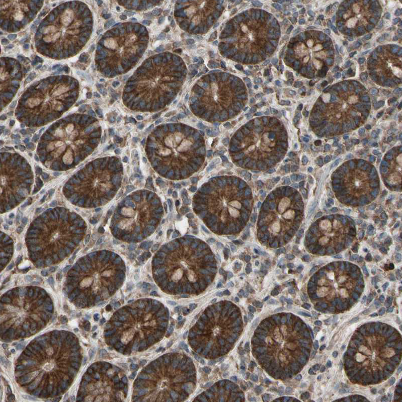 Anti-TNFRSF1A Antibody