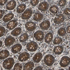 Anti-TNFRSF1A Antibody