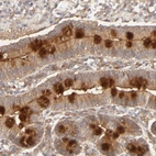 Anti-AP1G2 Antibody