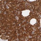 Anti-RPS29 Antibody