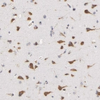 Immunohistochemical staining of human cerebral cortex shows strong cytoplasmic positivity in neurons.
