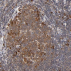Immunohistochemical staining of human tonsil shows strong cytoplasmic positivity in germinal center cells.