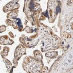 Immunohistochemical staining of human placenta shows moderate cytoplasmic positivity in trophoblastic cells.