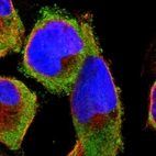 Immunofluorescent staining of human cell line A-431 shows localization to cytosol & endoplasmic reticulum.