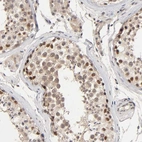 Immunohistochemical staining of human testis shows strong nuclear positivity in a subset of cells in seminiferous ducts.