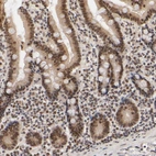 Immunohistochemical staining of human duodenum shows strong nuclear positivity in glandular cells.