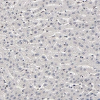 Immunohistochemical staining of human liver shows no positivity in hepatocytes as expected.