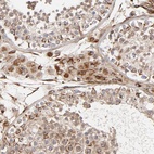 Anti-DNAAF2 Antibody