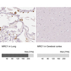 Anti-MRC1 Antibody