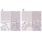 Immunohistochemical staining of human cerebral cortex, liver, lung and placenta using Anti-MRC1 antibody HPA004114 (A) shows similar protein distribution across tissues to independent antibody HPA045134 (B).