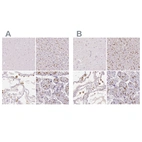Immunohistochemical staining of human cerebral cortex, liver, lung and placenta using Anti-MRC1 antibody HPA004114 (A) shows similar protein distribution across tissues to independent antibody HPA045134 (B).