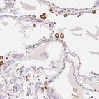 Immunohistochemical staining of human lung shows strong cytoplasmic positivity in macrophages.