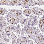 Immunohistochemical staining of human placenta shows strong cytoplasmic positivity in Hofbauer cells.