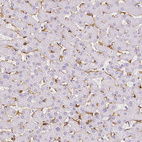 Anti-MRC1 Antibody