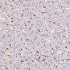 Immunohistochemical staining of human liver shows moderate cytoplasmic positivity in Kupffer cells.