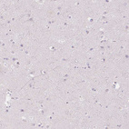 Immunohistochemical staining of human cerebral cortex shows no cytoplasmic positivity in neurons as expected.