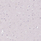 Anti-MRC1 Antibody