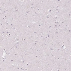 Immunohistochemical staining of human cerebral cortex shows no cytoplasmic positivity in neurons as expected.