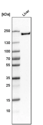 Western blot analysis in human liver tissue.