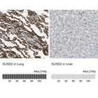 Anti-SUSD2 Antibody