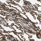 Immunohistochemical staining of human lung shows strong membranous positivity in pneumocytes.