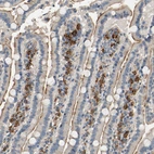 Immunohistochemical staining of human duodenum shows moderate membranous positivity in glandular and lymphoid cells.