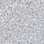 Immunohistochemical staining of human liver shows low positivity in hepatocytes as expected.