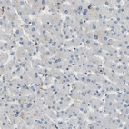 Immunohistochemical staining of human liver shows low positivity in hepatocytes as expected.