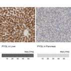 Anti-PYGL Antibody