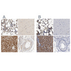 Anti-PYGL Antibody