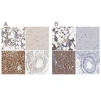 Immunohistochemical staining of human bone marrow, cerebral cortex, liver and testis using Anti-PYGL antibody HPA004119 (A) shows similar protein distribution across tissues to independent antibody HPA000962 (B).