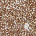 Immunohistochemical staining of human liver shows strong cytoplasmic positivity in hepatocytes.