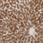 Immunohistochemical staining of human liver shows strong cytoplasmic positivity in hepatocytes.
