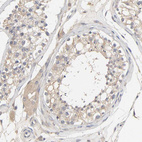 Anti-PYGL Antibody