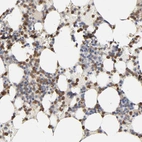 Immunohistochemical staining of human bone marrow shows moderate cytoplasmic positivity in hematopoietic cells.