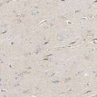 Anti-PYGL Antibody