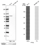 Western blot analysis in human cell lines PC-3 and SK-MEL-30 using Anti-PYGL antibody. Corresponding PYGL RNA-seq data are presented for the same cell lines. Loading control: Anti-PFN1.