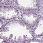 Immunohistochemical staining of human prostate shows low expression as expected.