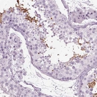 Immunohistochemical staining of human testis shows high expression.