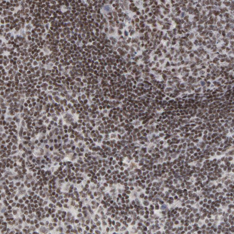 Anti-CTCF Antibody