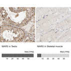 Anti-MARS Antibody